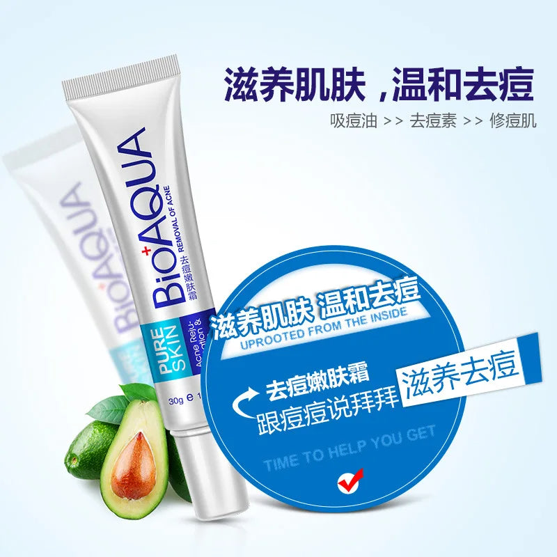 Bioaqua 30g Acne Treatment Blackhead Remova Anti Acne Cream Oil Control Shrink Pores Acne Scar Remove Face Care Whitening