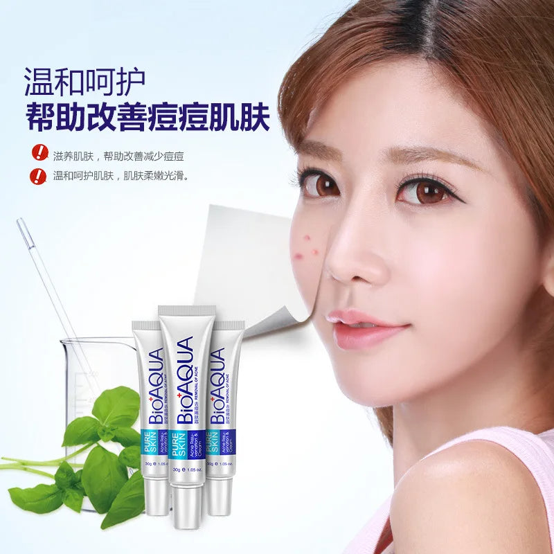 Bioaqua 30g Acne Treatment Blackhead Remova Anti Acne Cream Oil Control Shrink Pores Acne Scar Remove Face Care Whitening