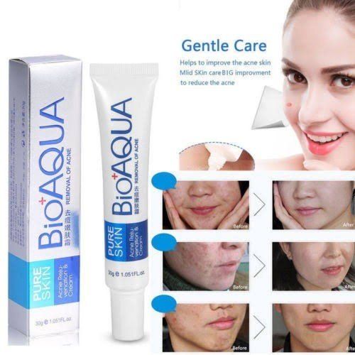 Bioaqua 30g Acne Treatment Blackhead Remova Anti Acne Cream Oil Control Shrink Pores Acne Scar Remove Face Care Whitening